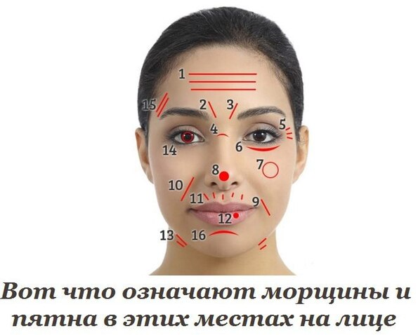 На лице пятна с чем это связано На лице пятна с чем это связано